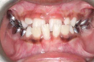 After