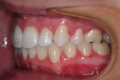 Before